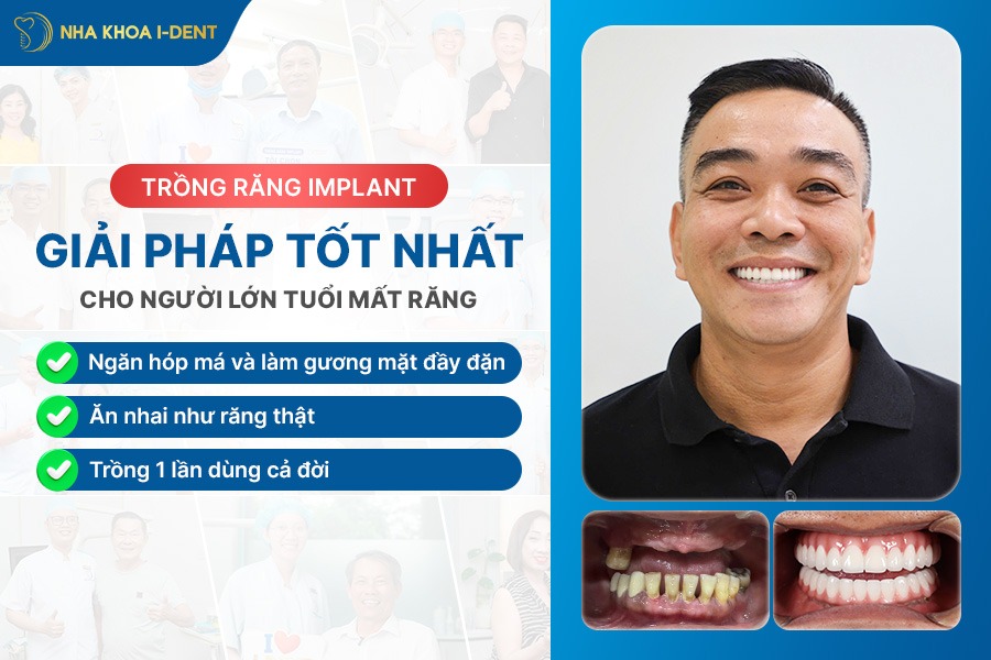 răng giả cho người già bao nhiêu tiền