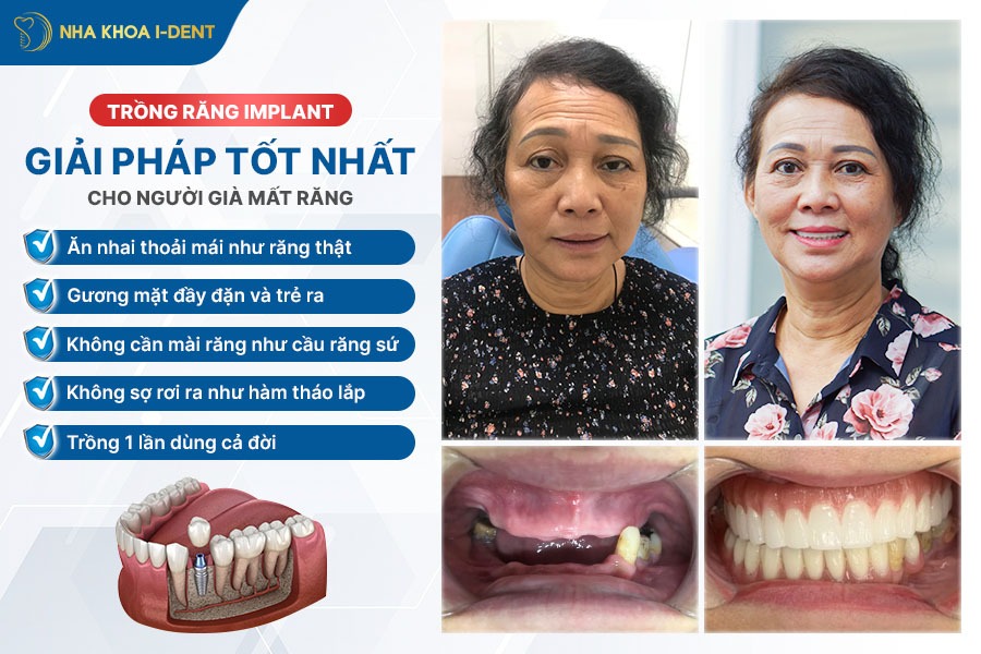 răng giả cho người già