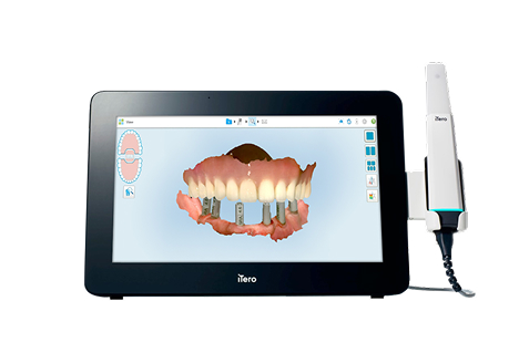 Nha khoa I-Dent ứng dụng công nghệ iTero Multi-Direct Capture trong dịch vụ niềng răng trong suốt Invisalign.