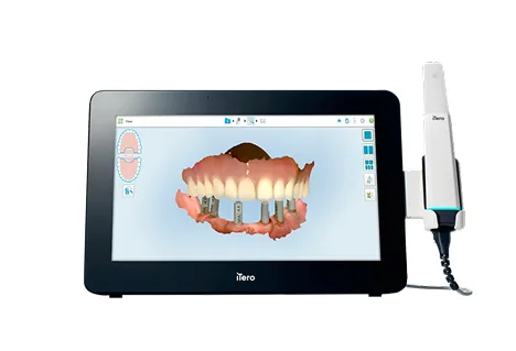 Nha khoa I-Dent ứng dụng công nghệ iTero Multi-Direct Capture trong dịch vụ niềng răng trong suốt Invisalign.
