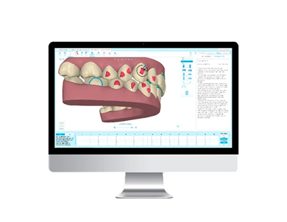 Nha khoa I-Dent sử dụng phần mềm Clincheck mô phỏng chuyển động răng 3D.