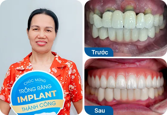Cô Nguyễn Thị Thủy