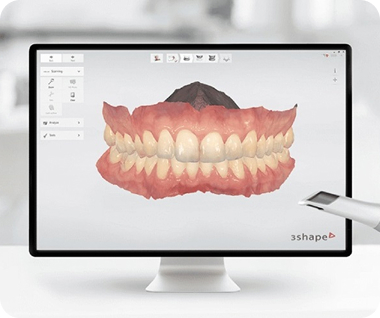 Nha khoa I-Dent ứng dụng công nghệ Scan 3D trong chế tác răng sứ.