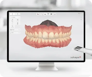 Nha khoa I-Dent ứng dụng công nghệ Scan 3D trong chế tác răng sứ.