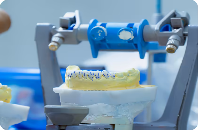 Nha khoa I-Dent có phòng labo răng sứ tích hợp riêng ngay trong phòng khám.