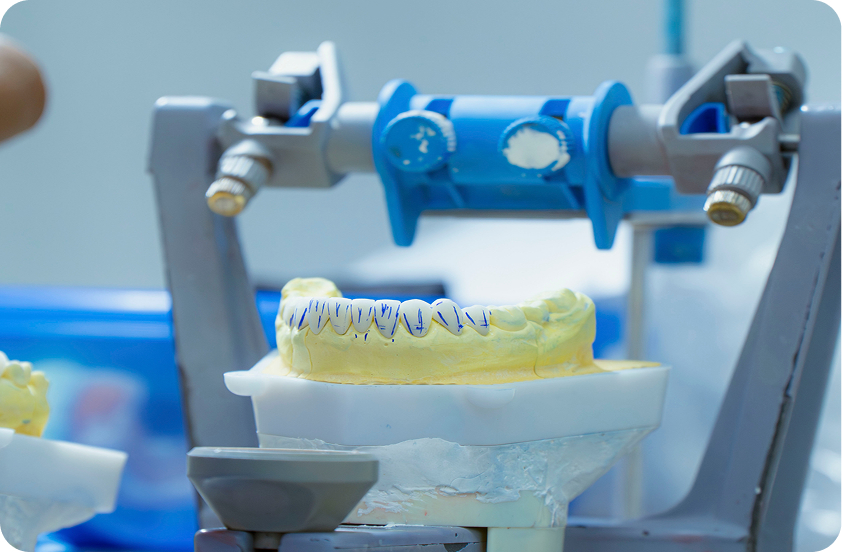 Nha khoa I-Dent có phòng labo răng sứ tích hợp riêng ngay trong phòng khám.
