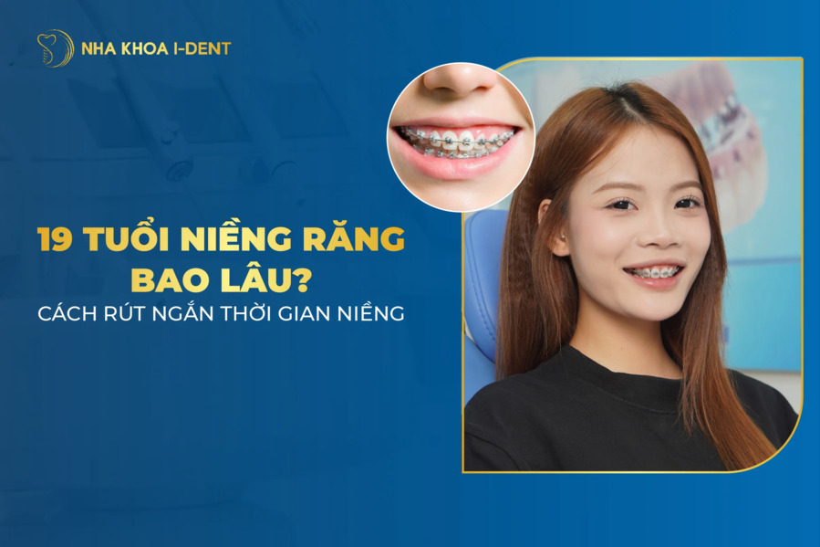 19 tuổi niềng răng bao lâu? Làm sao để rút ngắn thời gian niềng