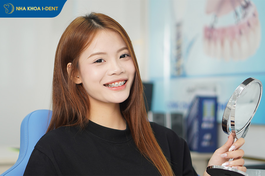 19 tuổi niềng răng bao nhiêu tiền