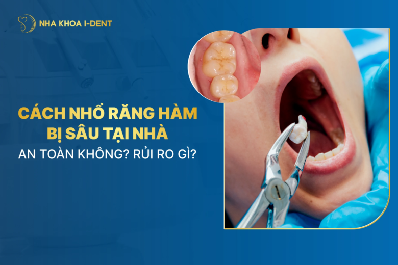 Cách nhổ răng hàm bị sâu tại nhà: An toàn không? Rủi ro gì?