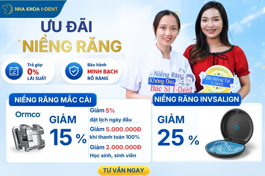 chi phí niềng răng 2 hàm