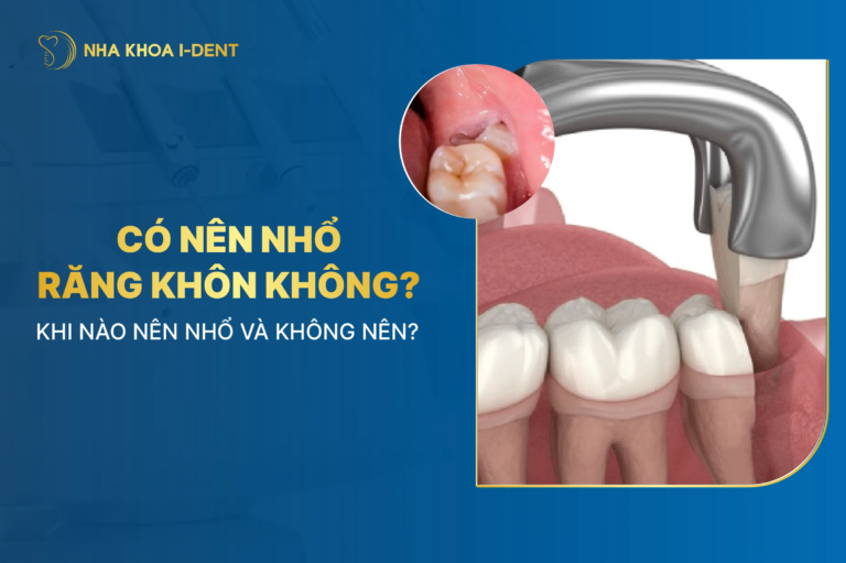 có nên nhổ răng khôn