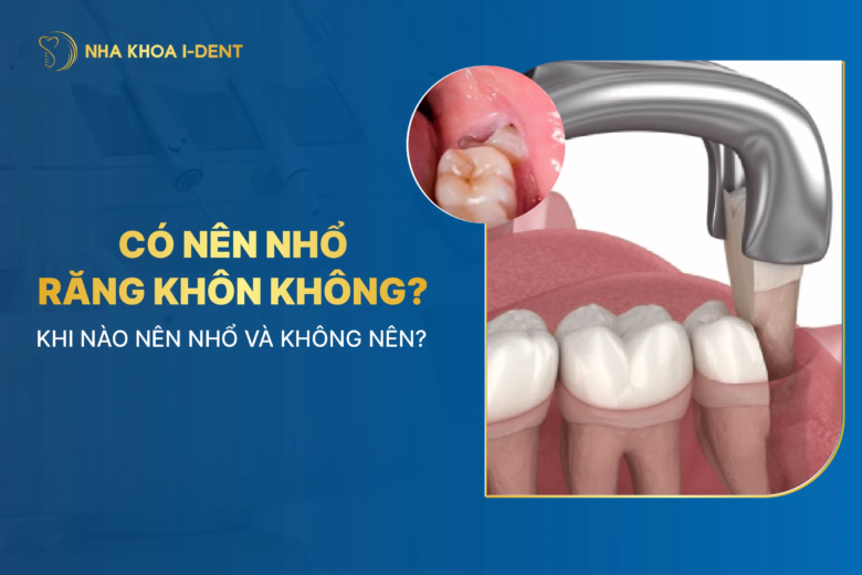 có nên nhổ răng khôn