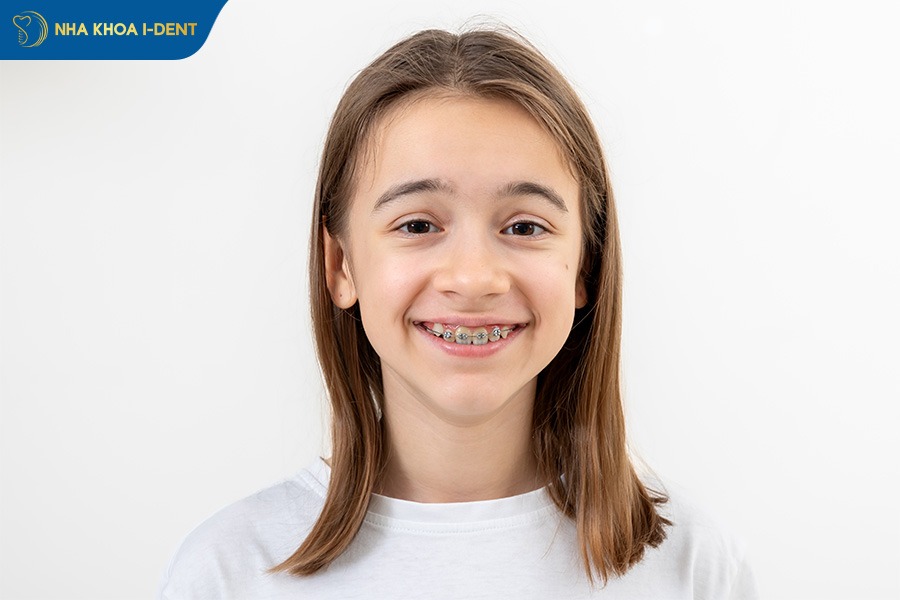 giá niềng răng cho trẻ 8 tuổi