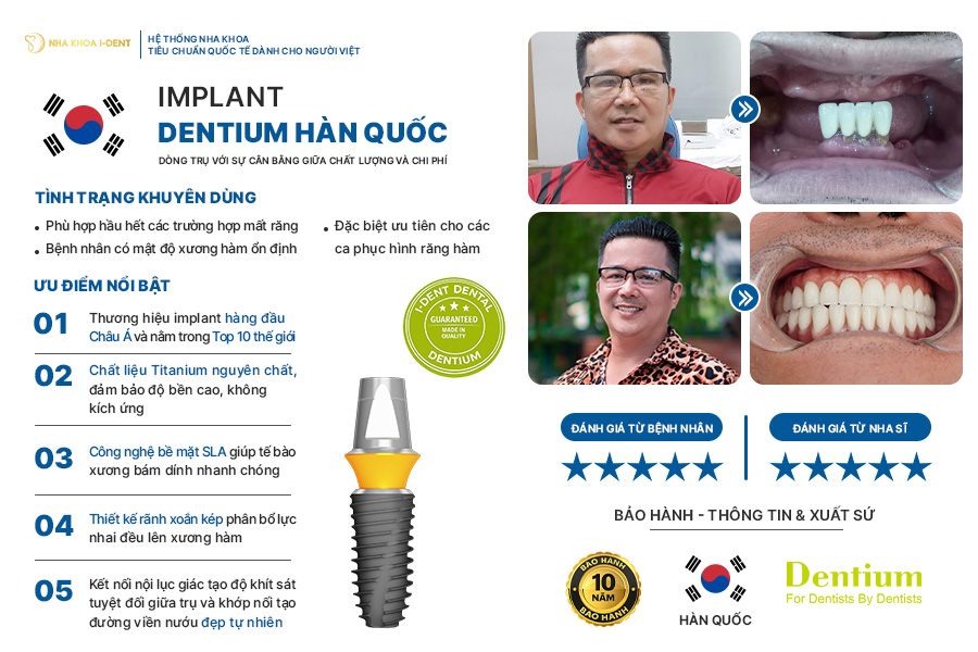 implant dentium - Nha khoa I-Dent