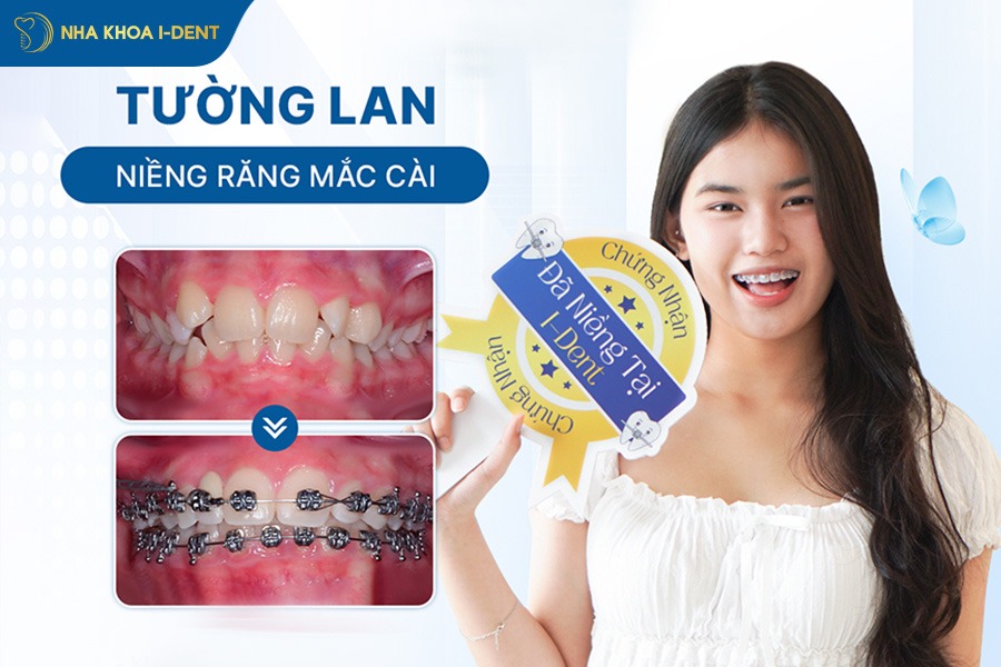 khách hàng niềng răng tại Nha khoa I-Dent