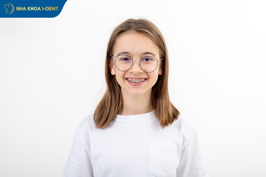 kinh nghiệm niềng răng invisalign