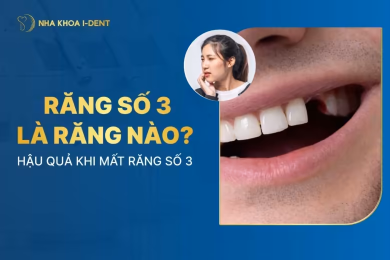 Răng số 3 là răng nào? 6 Hậu quả khi mất răng số 3