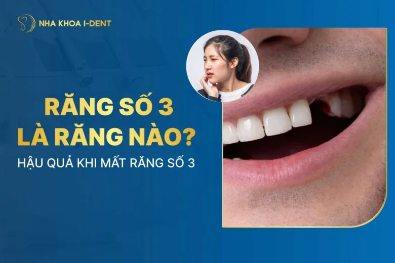 Răng số 3 là răng nào? 6 Hậu quả khi mất răng số 3