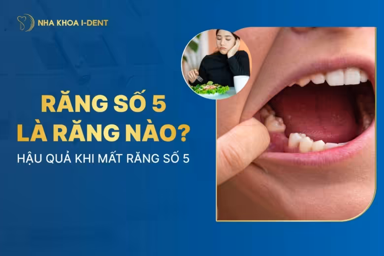 Răng số 5 là răng nào? Hậu quả khi mất răng số 5