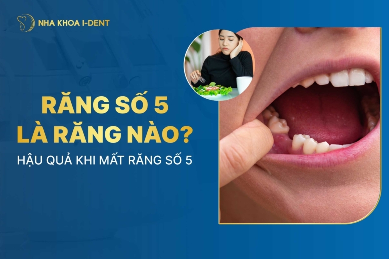 Răng số 5 là răng nào? Hậu quả khi mất răng số 5