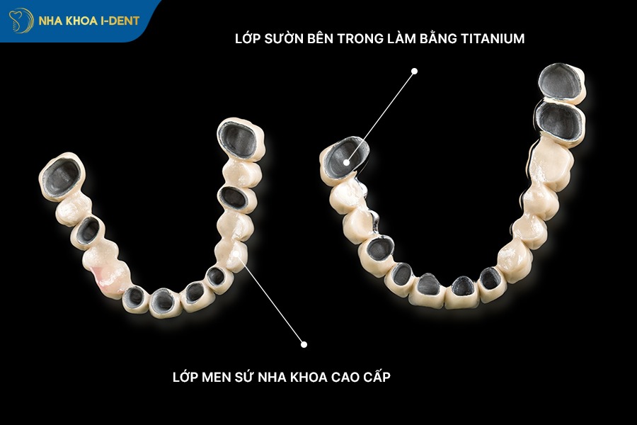 nên bọc răng sứ loại nào