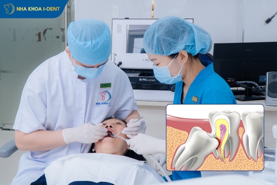 Nhổ răng khôn có được bảo hiểm y tế không