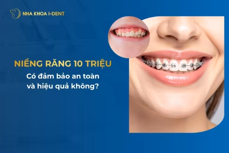 niềng răng 10 triệu