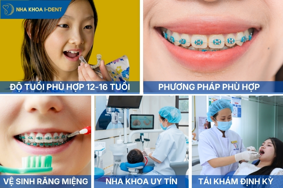 niềng răng cả 2 hàm giá bao nhiêu