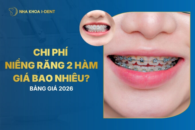 Niềng Răng 2 Hàm Giá Bao Nhiêu? Bảng Giá Mới 2026