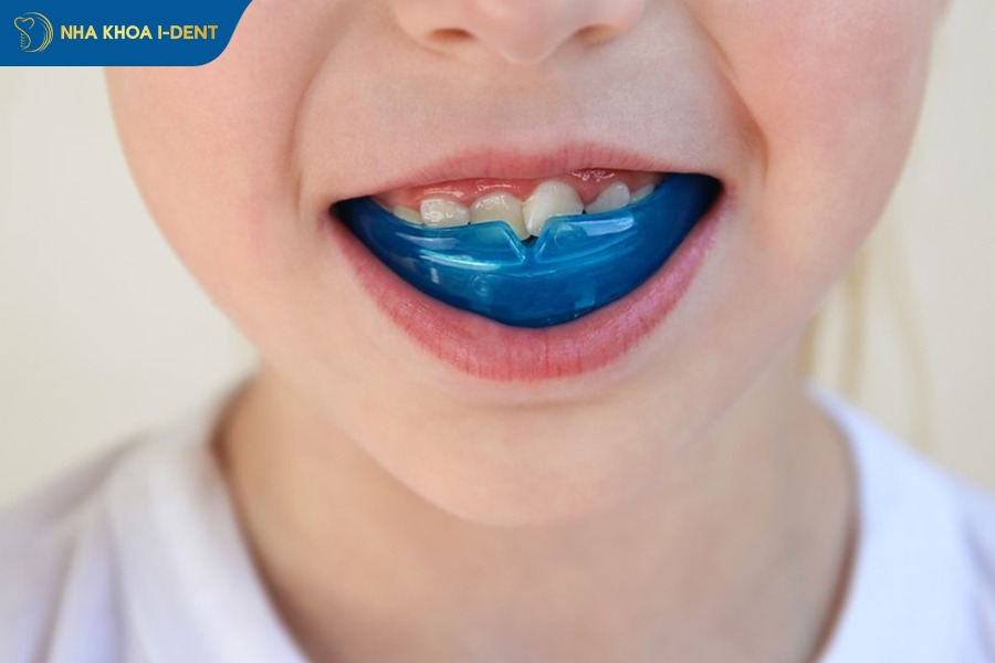 niềng răng cho bé 7 tuổi bằng hàm trainer