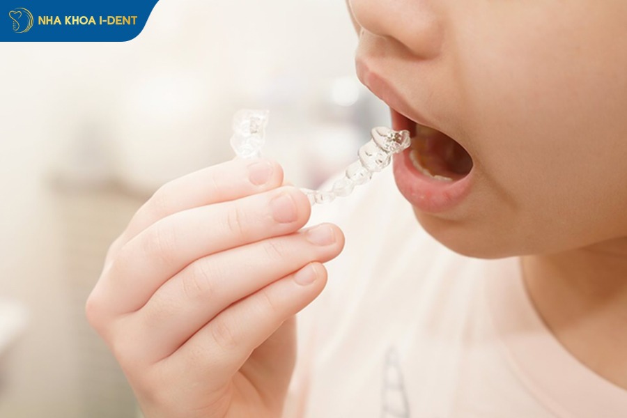 Niềng răng cho bé 7 tuổi bằng khay trong suốt invisalign