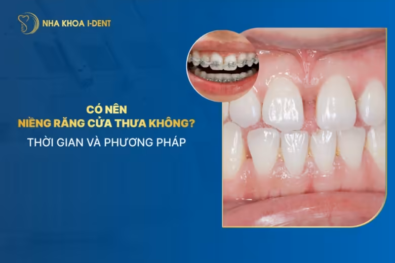 niềng răng cửa thưa