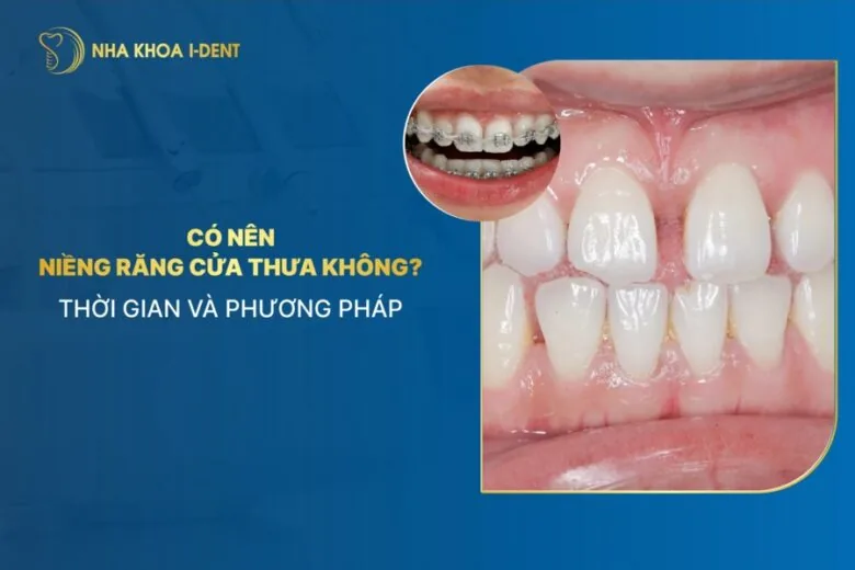 niềng răng cửa thưa