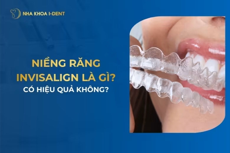 niềng răng invisalign là gì