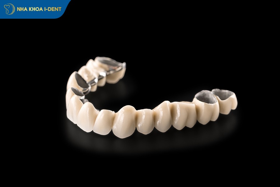 răng sứ titan có tốt không