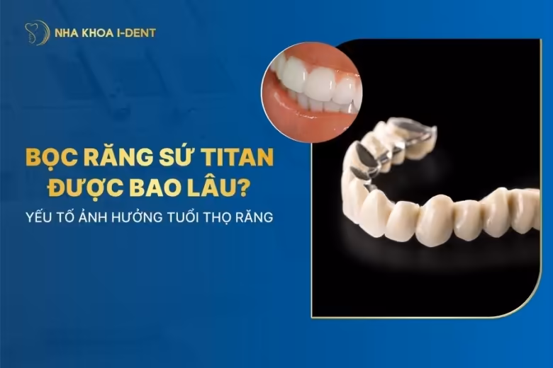 răng sứ titan sử dụng được bao lâu