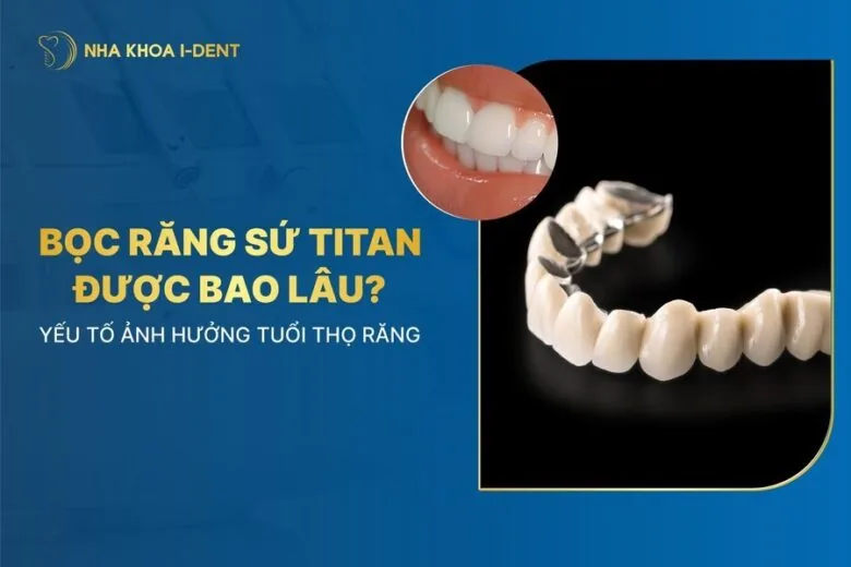 răng sứ titan sử dụng được bao lâu