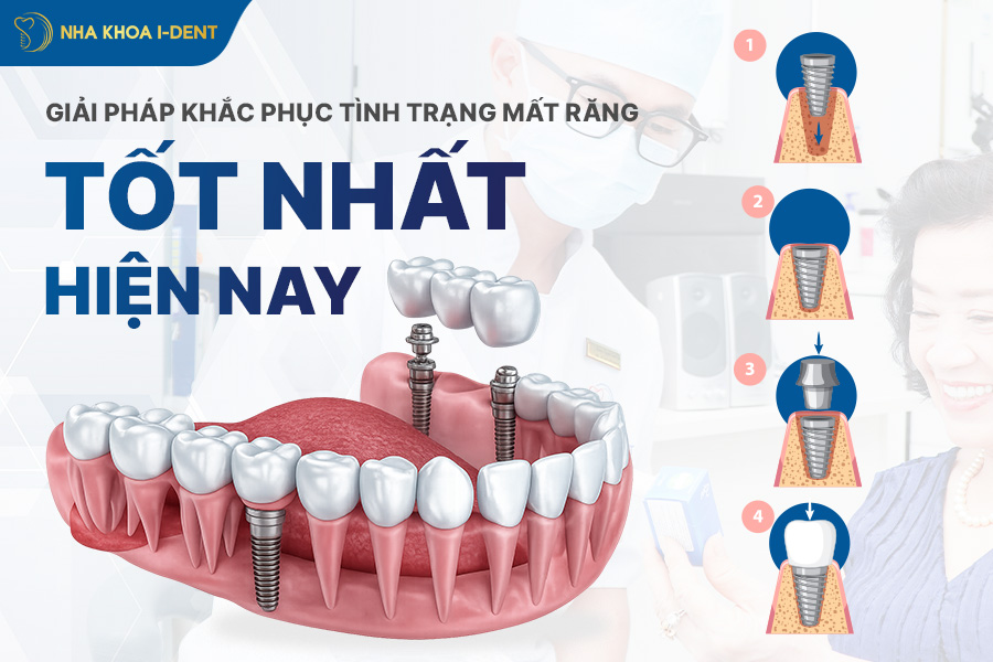 trồng răng giả có đau không - Nha khoa I-Dent
