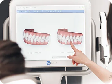 Công nghệ ClinCheck 3D cho phép xem hình ảnh mô phỏng nụ cười ở tương lai.