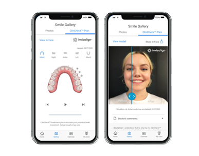 Ứng dụng My Invisalign đóng vai trò như trợ lý ảo nhắc nhở đeo khay, tái khám.