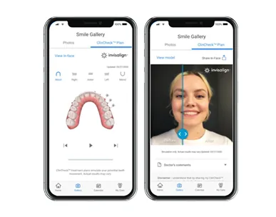 Ứng dụng My Invisalign đóng vai trò như trợ lý ảo nhắc nhở đeo khay, tái khám.