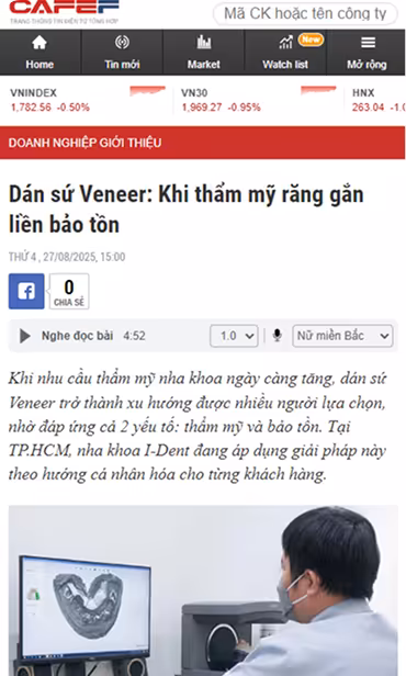 Báo chí CafeF đưa tin về dịch vụ dán sứ veneer tại nha khoa I-Dent.