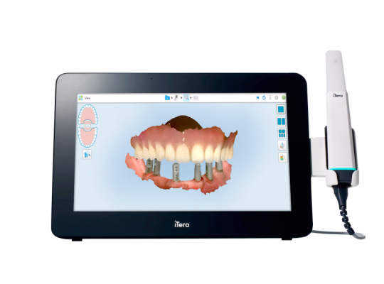 Nha khoa I-Dent ứng dụng công nghệ scan răng hiện đại iTero Multi-Direct Capture trong niềng răng trong suốt.