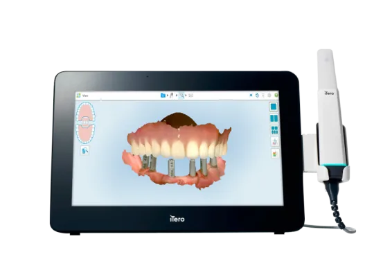 Nha khoa I-Dent ứng dụng công nghệ scan răng hiện đại iTero Multi-Direct Capture trong niềng răng trong suốt.