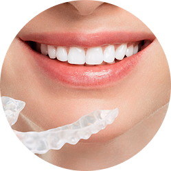 Dịch vụ niềng răng Invisalign.
