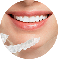 Dịch vụ niềng răng Invisalign.