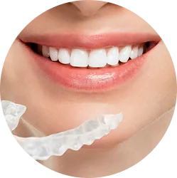 Dịch vụ niềng răng Invisalign.