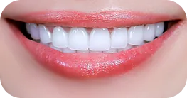 Dáng răng dễ thương