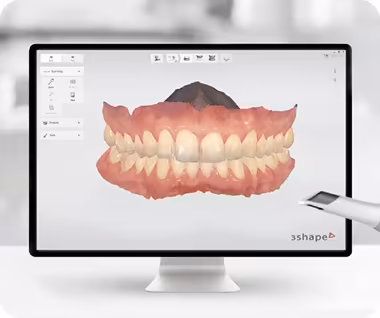 Nha khoa I-Dent ứng dụng công nghệ scan răng 3D, đảm bảo miếng dán veneer sát khít hoàn hảo.
