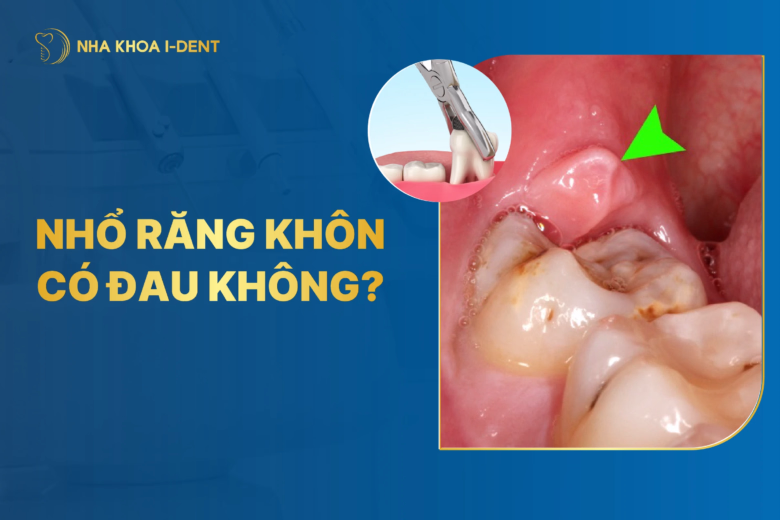 nhổ răng khôn có đau không